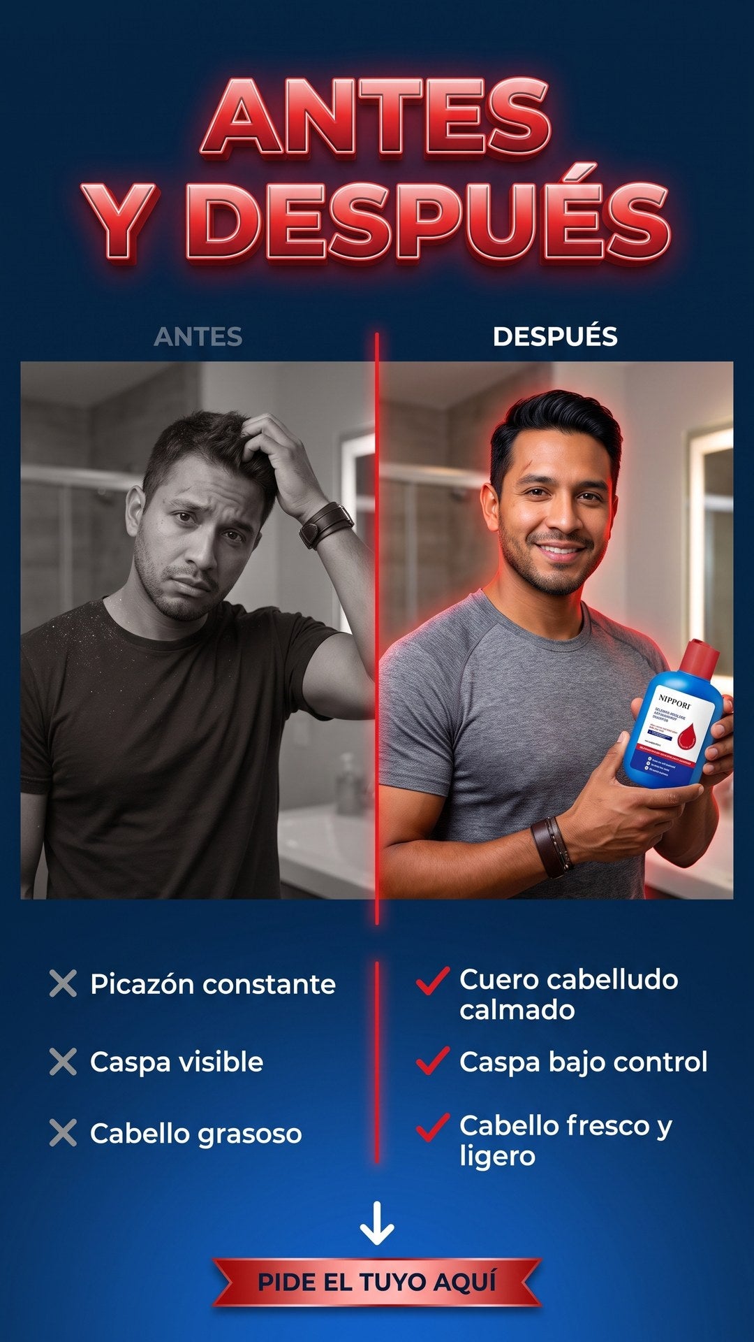 Antes y después de usar el champú anticaspa NIPPORI: cuero cabelludo con caspa y picazón versus cabello limpio y fresco